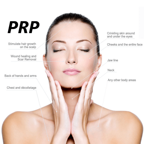 PRP, platelet rich plasma, vampire facial, edenmed, chelsea, bournemouth